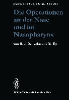 Die Operationen an der Nase und im Nasopharynx