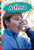 Asthma