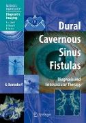 Dural Cavernous Sinus Fistulas