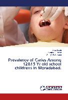 Prevalence of Caries Among 12&15 Yr old school childrens in Moradabad