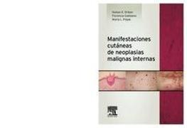 Manifestaciones cutáneas de neoplasias malignas internas