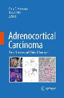 Adrenocortical Carcinoma