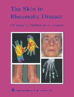 The Skin in Rheumatic Disease