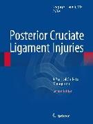 Posterior Cruciate Ligament Injuries