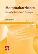 Mammakarzinom - Krankheitsbild und Therapie