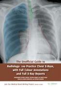 The Unofficial Guide to Radiology: 100 Practice Chest X Rays with Full Colour Annotations and Full X Ray Reports