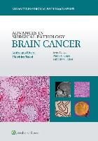 Advances in Surgical Pathology: Brain Cancer