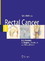 Rectal Cancer