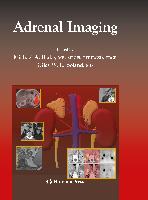 Adrenal Imaging