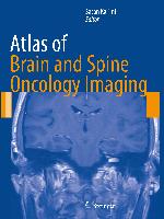 Atlas of Brain and Spine Oncology Imaging