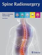 Spine Radiosurgery