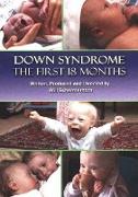 Down Syndrome DVD