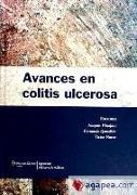 Avances en colitis ulcerosa