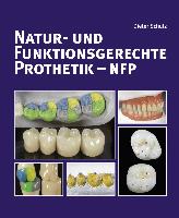 Natur- und funktionsgerechte Prothetik - NFP