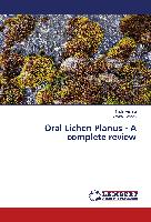 Oral Lichen Planus - A complete review