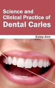 Science and Clinical Practice of Dental Caries