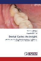 Dental Caries: An insight
