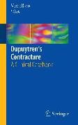 Dupuytren’s Contracture