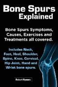 Bone Spurs Explained. Bone Spurs Symptoms, Causes, Exercises and Treatments All Covered. Includes Neck, Foot, Heel, Shoulder, Spine, Knee, Cervical, H