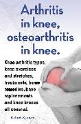 Arthritis in knee, osteoarthritis in knee. Knee arthritis types, knee exercises and stretches, treatments, home remedies, knee replacements and knee braces all covered