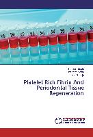 Platelet Rich Fibrin And Periodontal Tissue Regeneration
