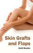 Skin Grafts and Flaps