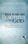 Your Scars Are Beautiful to God: Finding Peace and Purpose in the Hurts of Your Past