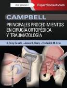Campbell : principales procedimientos en cirugía ortopédica y traumatología , Expertconsult