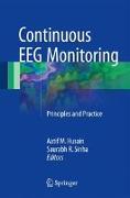 Continuous EEG Monitoring