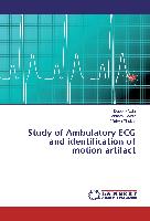 Study of Ambulatory ECG and identification of motion artifact