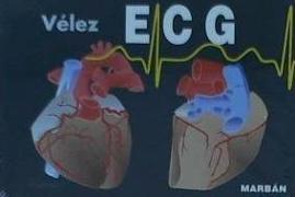 ECG, pautas de electrocardiografía