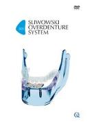 SOS - Sliwowski Overdenture System