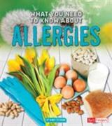 What You Need to Know About Allergies