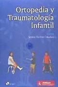 Ortopedia y Traumatología Infantil
