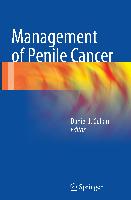 Management of Penile Cancer