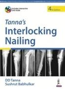 Tanna's Interlocking Nailing