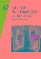Fast Facts: Non-Small-Cell Lung Cancer