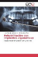 Rehabilitación con implantes cigomáticos