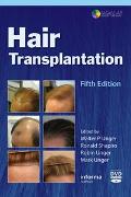 Hair Transplantation