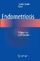 Endometriosis