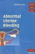 Abnormal Uterine Bleeding with DVD