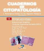 Citología ginecológica : infecciones fúngicas : virus del papiloma humano (HPV)