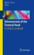 Osteonecrosis of the Femoral Head