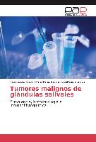 Tumores malignos de glándulas salivales