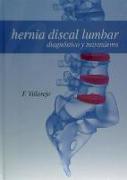 Hernia discal lumbar : diagnóstico y tratamiento