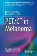 PET/CT in Melanoma