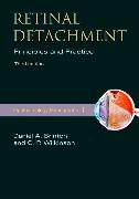 Retinal Detachment