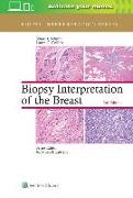 Biopsy Interpretation of the Breast