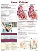 Heart Failure Anatomical Chart