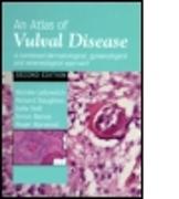 An Atlas of Vulval Diseases
